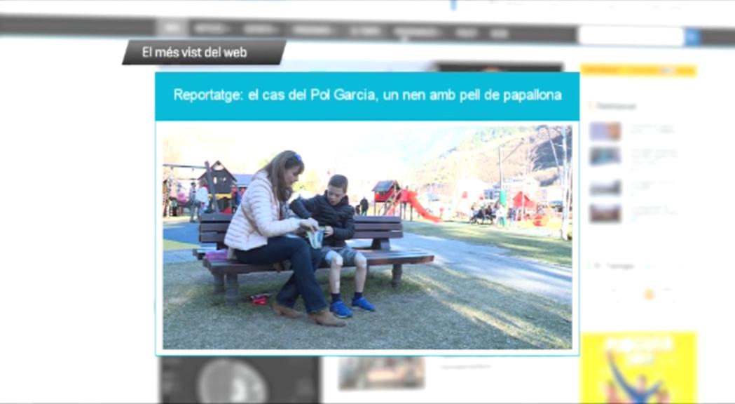 El reportatge del nen amb pell de papallona i la campanya de la policia, el més vist al web